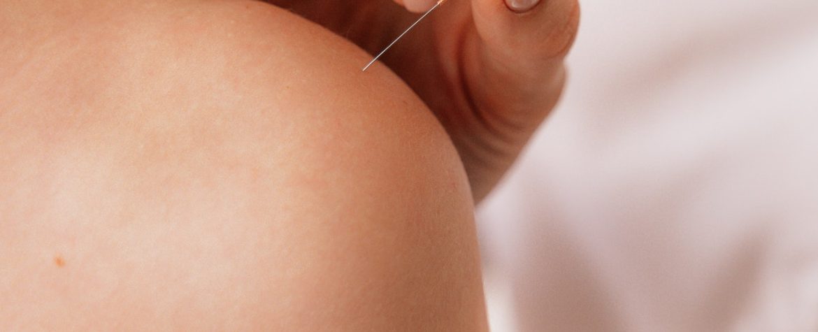 Pourquoi l’acupuncture est-elle efficace pour soulager la douleur ?